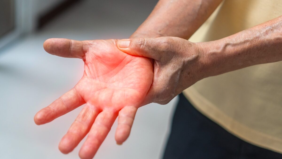 Illustration d'une dysesthésie de la jambe avec le trajet des nerfs sensitifs